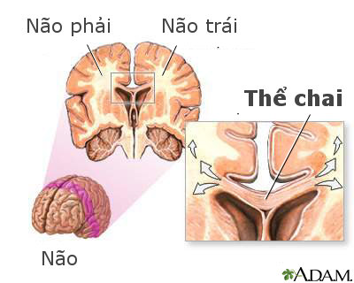 Thể chai (corpus callosum)